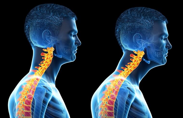 align-chiro-and-wellness-test-neck